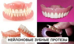 Irrotettava nylon hampaat - variantti proteesi