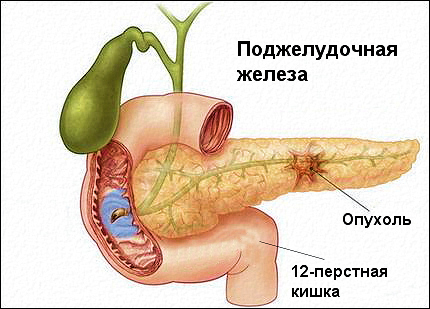 Derrota do pâncreas