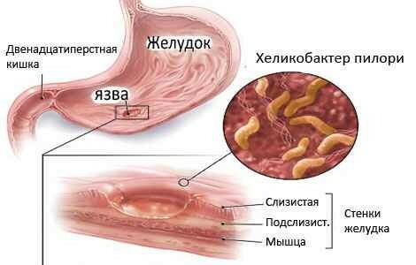 Structure and function of the stomach in the human body