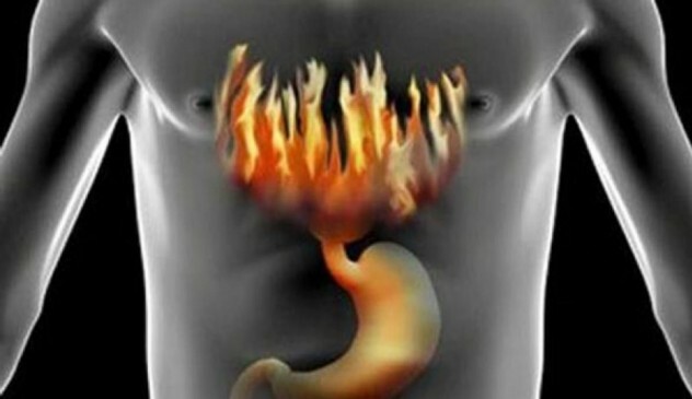 Reflux gastritída: symptómy, príčiny a liečba