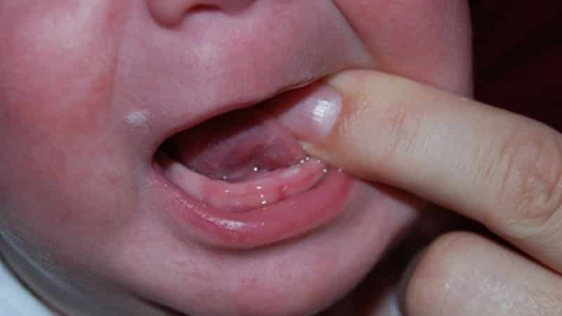 Miten purukumi vauvoilla ennen hampaiden puhkeaminen