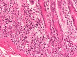 Processos putrefativos no intestino
