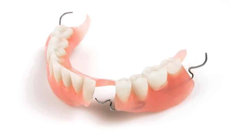 uma prótese é melhor na ausência de dentes