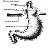 Methods of treatment of hernia of the esophagus