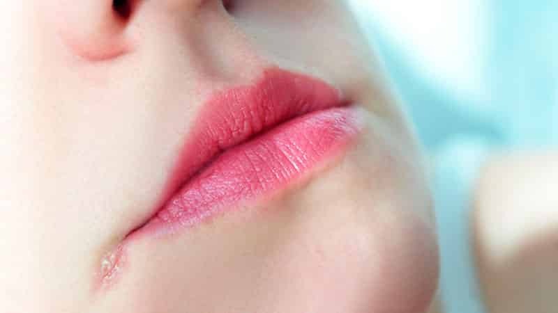 Perleches angoli della bocca: cause e trattamento