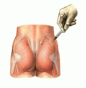 verdoving injectie