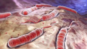 Cholera choroba