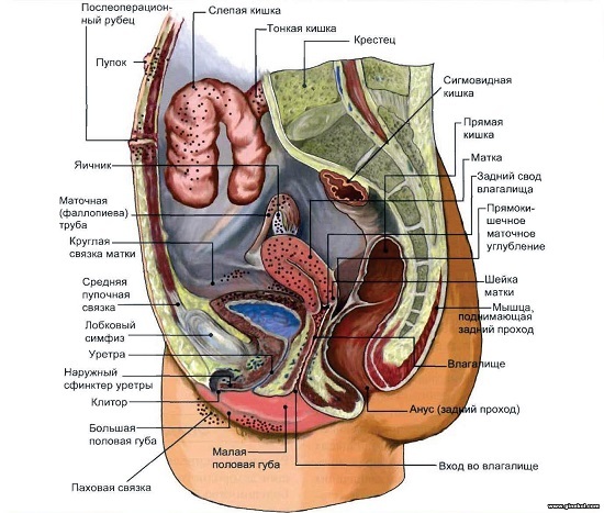 Area-lesion-in-endometriosis