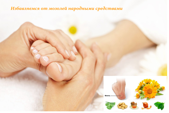 Treatment of calluses with the help of traditional medicine
