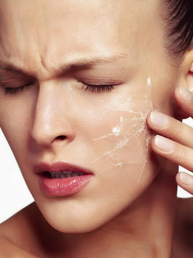 Zeer gevoelige huid: oorzaken en zorg regels