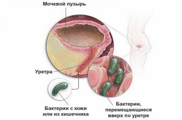 Treatment of the urinary system