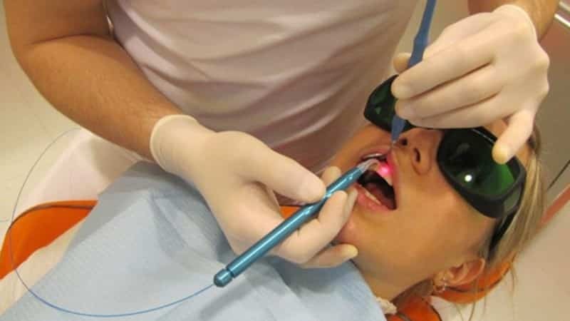Zánět dásní u dětí: fotky, příznaky a typy léčby