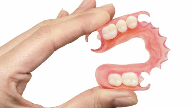 nylon částečné zubní protéza