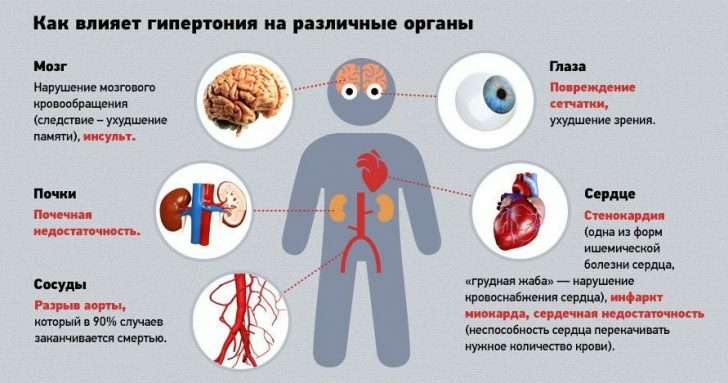 Hypertension 2