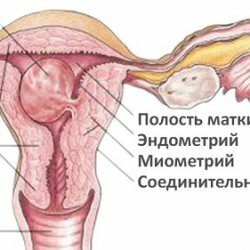 Causes of myometrial changes