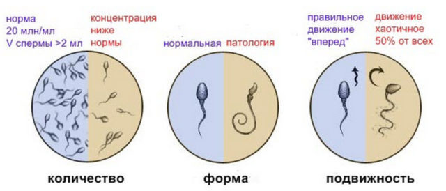 Die niedrige Konzentration von Spermien und kriptospermiya: Ursachen und Behandlung