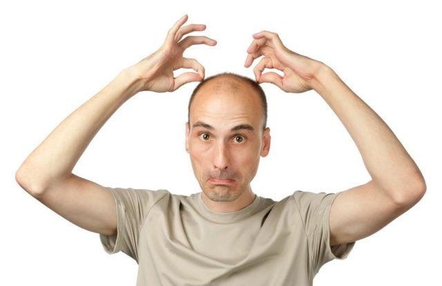 Perdita di capelli negli uomini: cause e metodi di trattamento