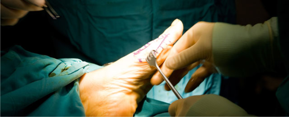 Operation, um die Beulen auf seinem Bein zu entfernen