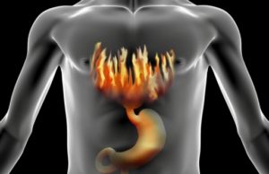 Burning in the chest