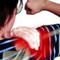 Inflammation of the shoulder joint
