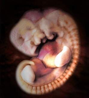 7 Woche Schwangerschaftsfoto