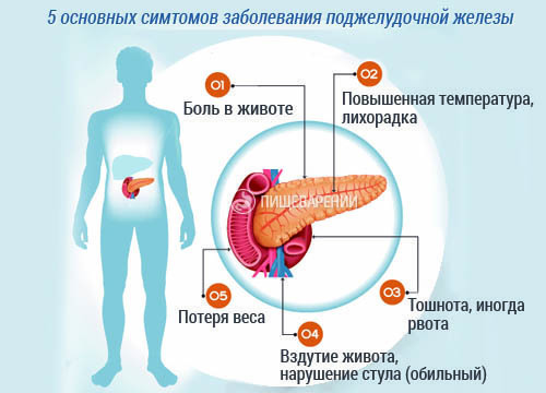 Sintomas de problemas pancreáticos