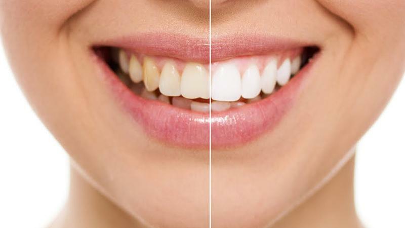 Bewertungen von Zahnpasta SPLAT Whitening plus