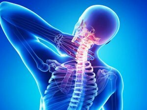 תכונות osteochondrosis צוואר הרחם