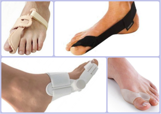 Ortopædiske værktøjer til at korrigere knogler på deres fødder