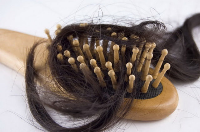 Zgodnje izpadanje las pri moških: vzroki in zdravljenje