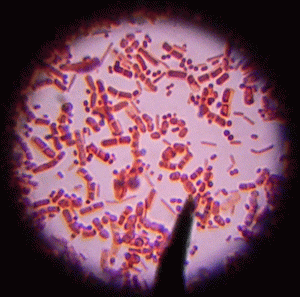 Dysbacteriosis ihmisillä