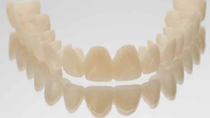 Crowns on the teeth on the front teeth: before and after photos, reviews, ceramic, zirconium, plastic