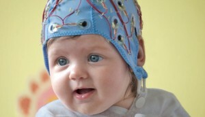 EEG bei Säuglingen