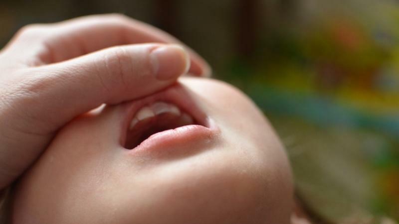 ząb dziecko ma przyciemniony po uderzeniu