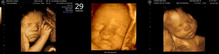 29th week of pregnancy: fetal development, mom's well-being