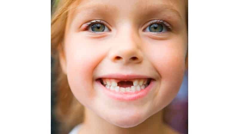 wymiana utraty zębów mlecznych u dzieci w wieku powyżej