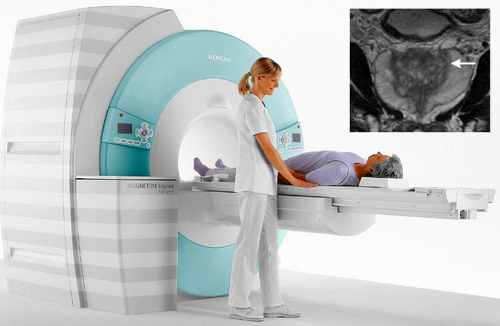 MRI of the prostate gland in men