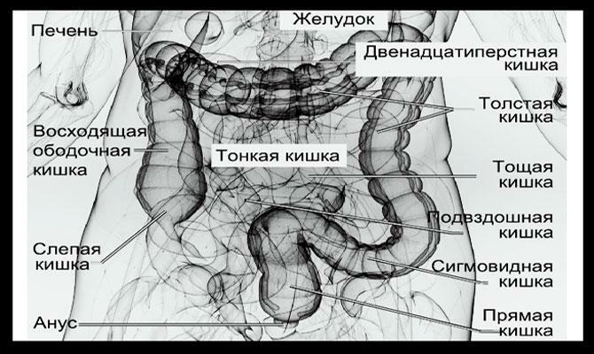Intestine MRI mit mutat