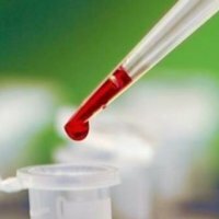 Antilichamen tegen insuline in het bloed