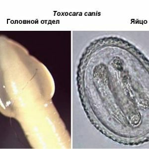 Toxocarose-toxocary