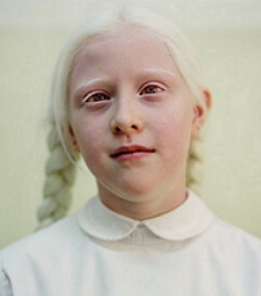 Albino fotografija