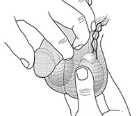 Testicular palpation