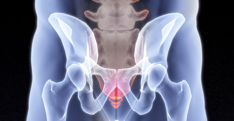 Pain in coccyx and anal-coccygeal suppuration