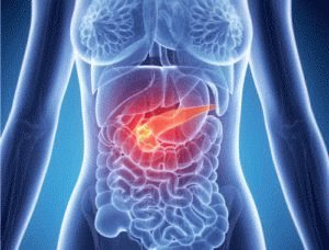 Pijn met pancreatitis