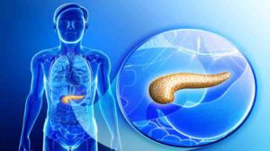 Pancreatitis humana
