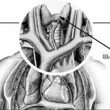 Nodules on the thyroid gland