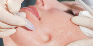 Was Gesicht Peeling von Akne ist besser und effektiver und wie es hilft, sie loszuwerden