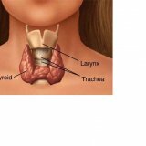 Thyroid dysfunction