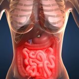 Treatment of candidiasis of the intestine