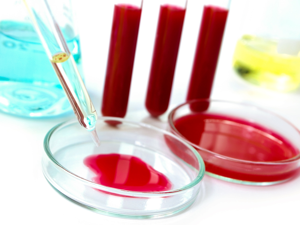 Ett blodprov för PSA: normer och avkodning